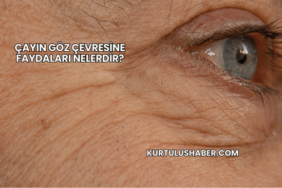 Çayın Göz Çevresine Faydaları Nelerdir?